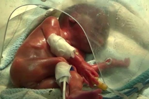 Vài giây trước khi an táng, "bé sinh non đã chết" được phát hiện còn sống - 1 Vài giây trước khi an táng, "bé sinh non đã chết" được phát hiện còn sống - 1