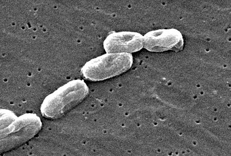 89.000 người chết trên thế giới do bệnh truyền nhiễm nguy hiểm Melioidosis - 1 Vi khuẩn Burkholderia pseudomallei (nguồn:http://diendanykhoa.com)