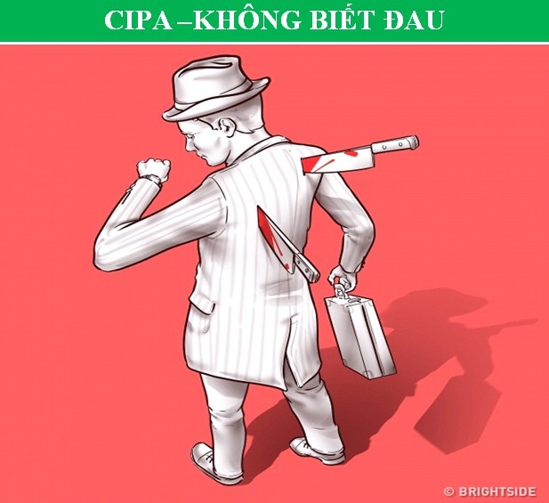 Những căn bệnh đặc biệt giúp người mắc phải sở hữu “siêu năng lực” - 2 Những căn bệnh đặc biệt giúp người mắc phải sở hữu “siêu năng lực” - 2