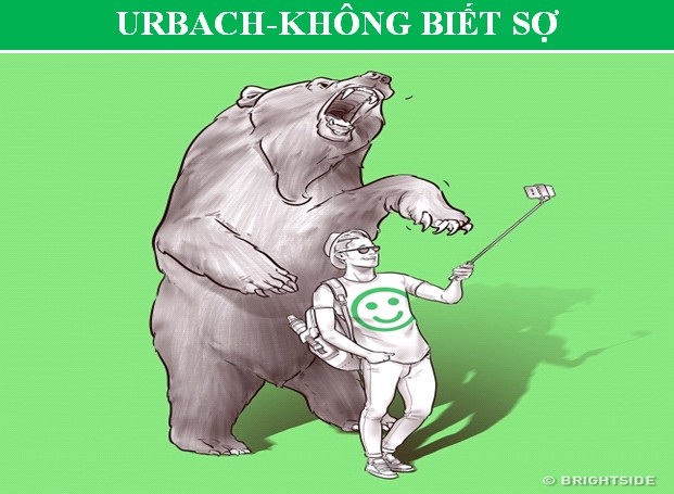 Những căn bệnh đặc biệt giúp người mắc phải sở hữu “siêu năng lực” - 5 Những căn bệnh đặc biệt giúp người mắc phải sở hữu “siêu năng lực” - 5