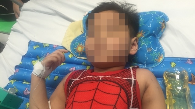 Cứu chân trái dập nát của bé trai 5 tuổi sau tai nạn - 1 Cháu bé trải qua ca phẫu thuật khó khăn đã may mắn qua khỏi nguy kịch và vẫn giữ được chân tổn thương dập nát sau tai nạn. Ảnh: Mai Chi