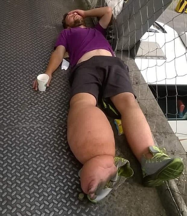 “Gã ăn mày xuyên lục địa” bị hãng hàng không từ chối phục vụ - 2 Du khách người Đức này lang thang tới nhiều quốc gia ở Đông Nam Á hành nghề ăn xin với đôi chân phù nề