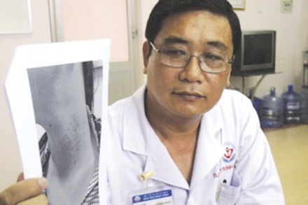 Tàn tạ dung nhan vì làm đẹp thiếu hiểu biết - 1
BS Phạm Trịnh Quốc Khanh cho xem hình ảnh cổ bệnh nhân nổi nốt chi chít sau khi tiêm chất làm trắng. Ảnh: M.P