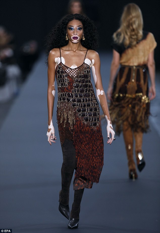 
Người mẫu bị bạch tạng Winnie Harlow
