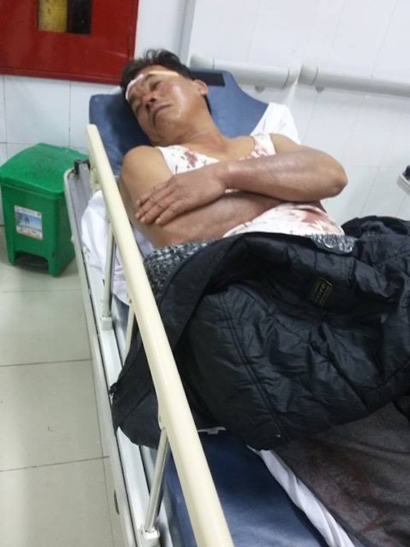 
Anh Trung được cấp cứu tại bệnh viện.
