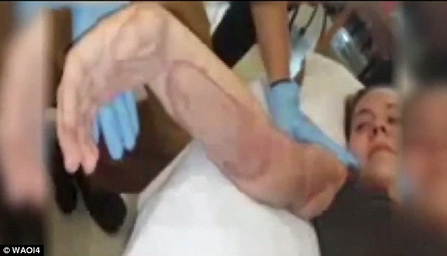 Kỳ diệu cánh tay nát bươm được hồi sinh - 4
Các bác sĩ đã phẫu thuật, phục hồi chức năng để nó có thể hoạt động