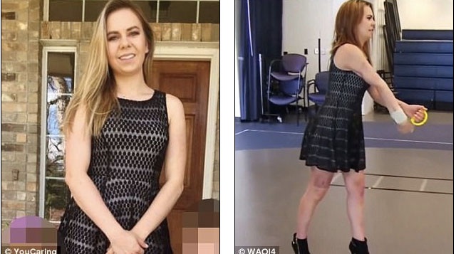 Kỳ diệu cánh tay nát bươm được hồi sinh - 5
Cô gái đã gần như trở lại nguyên vẹn và các chức năng của cánh tay đang có tiến bộ rõ rệt