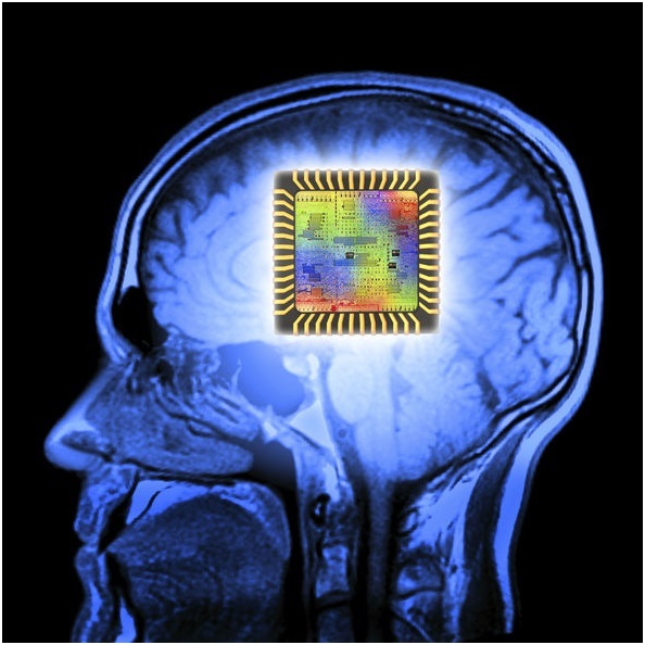 
Con chip sẽ được cấy vào bộ não.
