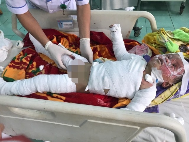 
Bé Khôi đã được gia đình chuyển xuống TPHCM để điều trị.
