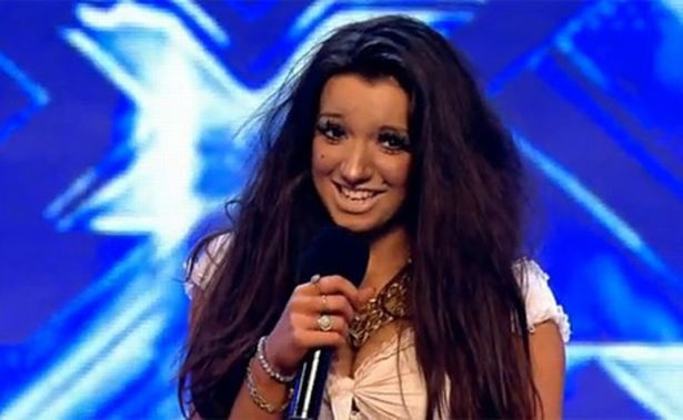 Nghẹt thở với thân hình "dao kéo" của sao "nghiện" phẫu thuật thẩm mỹ - 4
Chloe Khan khi mới gia nhập làng giải trí. Cô tham dự cuộc thi tìm kiếm tài năng X Factor tại Anh vào năm 2010. Lúc này, gương mặt của cô chưa hề được chỉnh sửa.