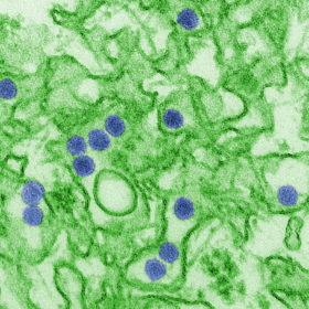 Các nhà khoa học Anh với tham vọng chữa ung thư não bằng… virus Zika - 1 Hình ảnh các hạt virus Zika.