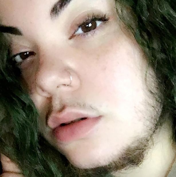 Cô gái có râu vẫn được bạn trai khen xinh - 2 Cô gái có râu vẫn được bạn trai khen xinh - 2