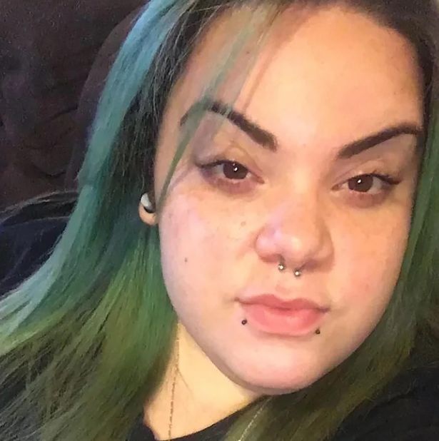 Cô gái có râu vẫn được bạn trai khen xinh - 5
Alma khi đã cạo râu.