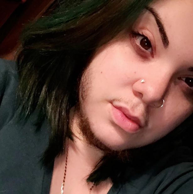 Cô gái có râu vẫn được bạn trai khen xinh - 4 Cô gái có râu vẫn được bạn trai khen xinh - 4