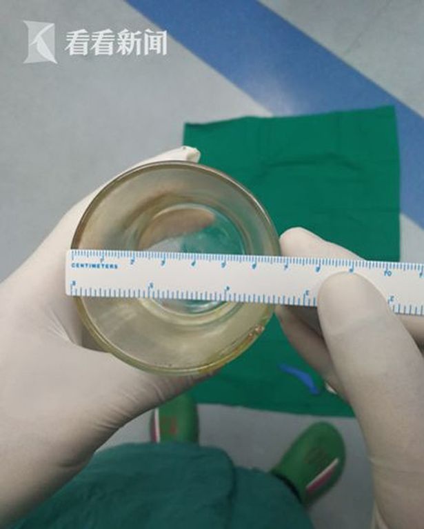 
Chiếc cốc có đường kính 7 cm, dài 8cm
