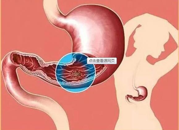 7 bệnh dễ chuyển thành ung thư nhất - 2 7 bệnh dễ chuyển thành ung thư nhất - 2
