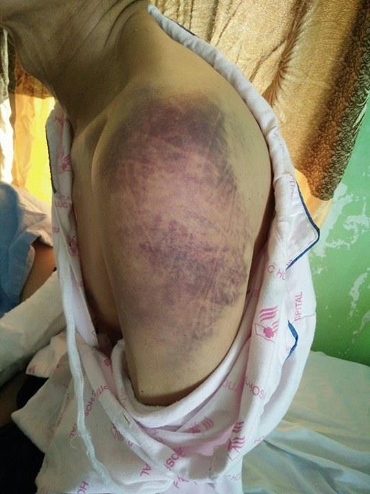 Cả nhà lao vào đánh chém hai vợ chồng hàng xóm như côn đồ - 4 Ông Ba đang điều trị tại Bệnh viện Đa khoa Hợp Lực