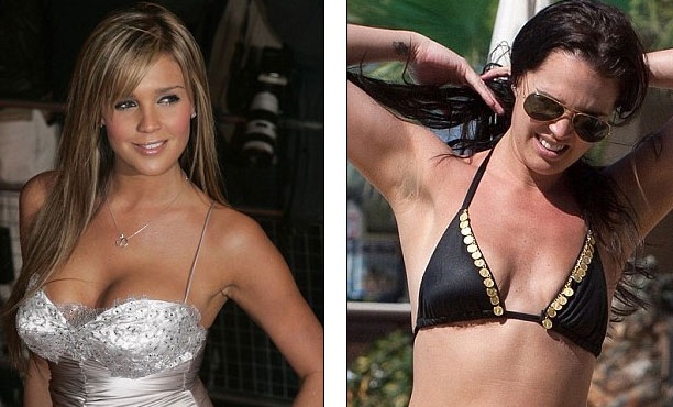 Danielle Lloyd: Nâng ngực khiến hôn nhân rạn nứt - 3
Danielle đã chịu hậu quả nặng nề sau khi phẫu thuật ngực tới 7 lần.