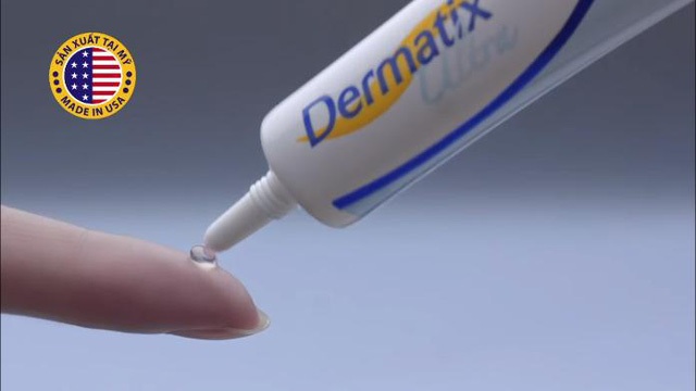 Sẹo sinh mổ - Băn khoăn khó nói của mẹ - 2 Sẹo sinh mổ - Băn khoăn khó nói của mẹ - 2