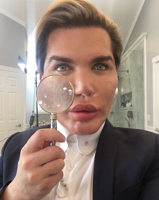 Chàng trai mê làm búp bê “sống” lộ mặt sưng phồng đáng sợ - 4
Rodrigo Alves sẽ phẫu thuật thẩm mỹ để có làn da mỏng mịn và căng bóng như sứ.