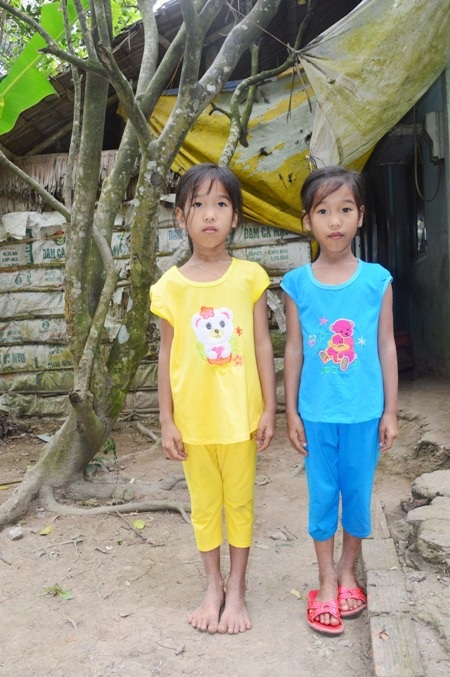 Cuộc sống khốn khó của chị em sinh đôi mang tên Mỹ Nhân, Mỹ Ái - 2 Hai cháu Mỹ Nhân (áo vàng) và Mỹ Ái hiện tại. Gia cảnh nghèo, đói ăn, thiếu mặc nên các cháu đã 8 tuổi, học lớp 2 nhưng trông rất ốm yếu, gầy còm.
