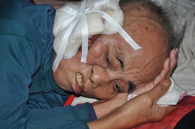 "Trước lúc nhắm mắt, ông nhà tôi biết ơn bạn đọc Dân trí lắm !" - 1 Bị khối u xâm lấn đã 2 năm nay khiến sức khỏe của bác Giang bị suy kiệt.