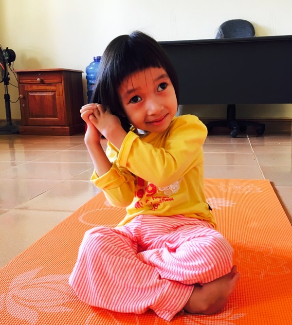 Niềm vui trong "ngôi nhà mới" của cô bé đa dị tật bẩm sinh bị bỏ rơi nơi bệnh viện - 5 Hiện tại bé Thuỳ Nhi vẫn đang rất cần sự quan tâm, sẻ chia của cộng đồng xã hội