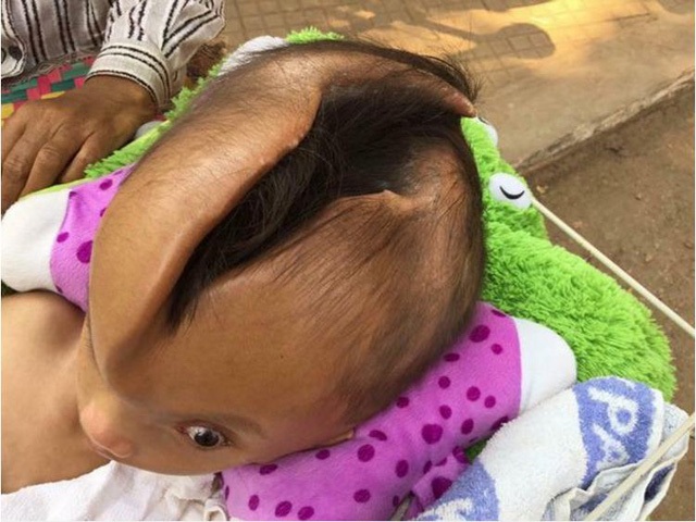 Sốc với cậu bé có rãnh hộp sọ nứt rộng hơn mỗi tuần - 1
Nguồn: Viral Press