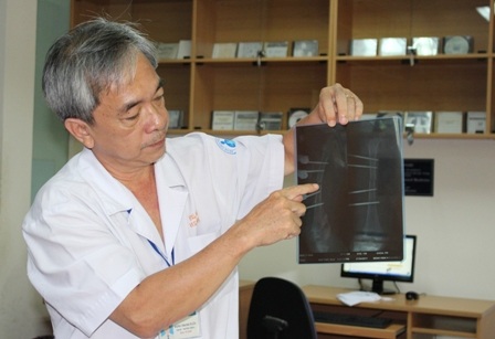 Xương đùi bị gãy gây chèn ép khoang suýt khiến bé mất mạng