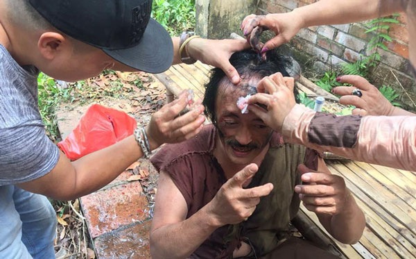 Thông tin nghệ sĩ Giang còi bị bạn diễn “cầm chai tương đánh vào mặt, máu chảy ròng ròng” khi quay một bộ phim mới đây thu hút sự chú ý của dư luận. Khi phóng viên liên lạc với nghệ sĩ Giang còi, anh phủ nhận thông tin bị bạn diễn cầm chai đánh vào mặt trong quá trình quay phim.