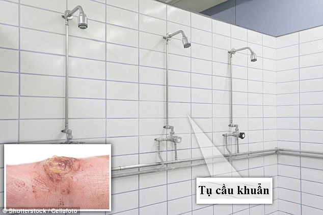 Những nguyên tắc số 1 giúp tránh nhiễm bệnh từ phòng tập gym - 3 Những nguyên tắc số 1 giúp tránh nhiễm bệnh từ phòng tập gym - 3