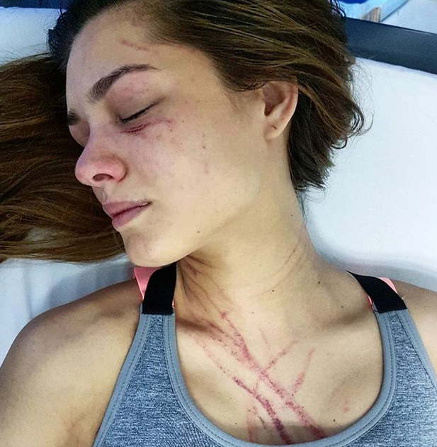 Hoa hậu trái đất bị ca sỹ gợi cảm đánh - 1
Hoa hậu trái đất Venezuela 2012 Osmariel Villalobos tung ảnh bị hành hung