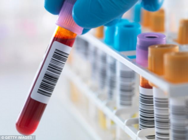 Đột phá: Phát hiện "thủ phạm" khiến bệnh AIDS không thể chữa khỏi - 1
Cho đến nay, việc điều trị tập trung vào HIV trốn trong tế bào T - một loại tế bào bạch cầu.