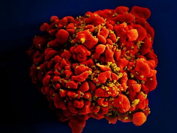 Ca nhiễm virus HIV được chữa khỏi thứ 3 trên thế giới - 1
Virus HIV. (Nguồn: independent.co.uk)