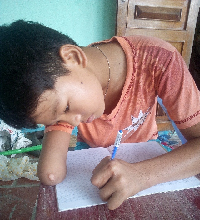 Cậu học trò khuyết tật hiếu học với ước mơ làm bác sĩ - 6 Cậu học trò khuyết tật hiếu học với ước mơ làm bác sĩ - 6