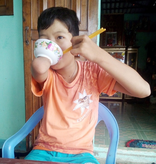 Cậu học trò khuyết tật hiếu học với ước mơ làm bác sĩ - 9 Cậu học trò khuyết tật hiếu học với ước mơ làm bác sĩ - 9
