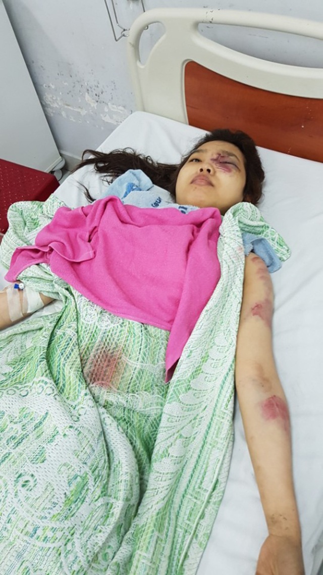 Tai nạn giao thông nghiêm trọng, 2 người chết, 14 người bị thương - 5 Một trong 14 nạn nhân đang cấp cứu tại bệnh viện