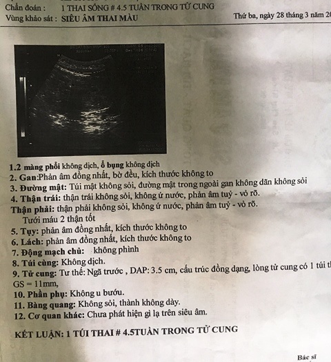 Bé gái 10 tuổi nghi bị hàng xóm xâm hại đến có thai - 2 Kết quả siêu âm của bé H.