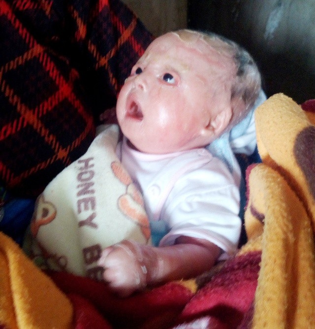 Hơn 259 triệu đồng đến với gia đình cháu bé bị “vẩy cá” - 1 Sinh ra, bé Nguyễn Hoàng Phú toàn thân phủ đầy vẩy cá.