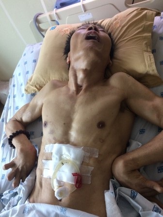 Vụ đòi bồi thường 23,6 tỷ: “Bệnh viện bao biện để bảo vệ cái sai của bác sĩ"? - 1 Sau thủ thuật, ông Trịnh Quang Sơn bị tai biến sống thực vật hơn 1 năm qua