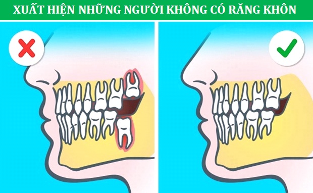 Những minh chứng cho thấy con người vẫn đang tiến hóa từng ngày - 6 Những minh chứng cho thấy con người vẫn đang tiến hóa từng ngày - 6