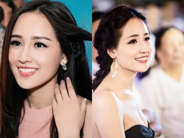 Căng da trắng hồng bằng chỉ vàng 24K - 1 Căng da trắng hồng bằng chỉ vàng 24K - 1