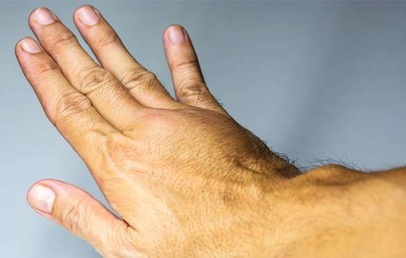 6 báo hiệu cơ thể có cục máu đông - 1 6 báo hiệu cơ thể có cục máu đông - 1