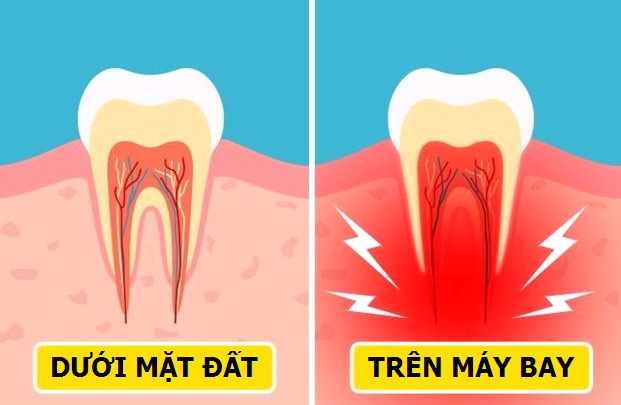 Giải mã những hiện tượng kỳ lạ xảy ra với cơ thể khi chúng ta đi máy bay - 7 Giải mã những hiện tượng kỳ lạ xảy ra với cơ thể khi chúng ta đi máy bay - 7
