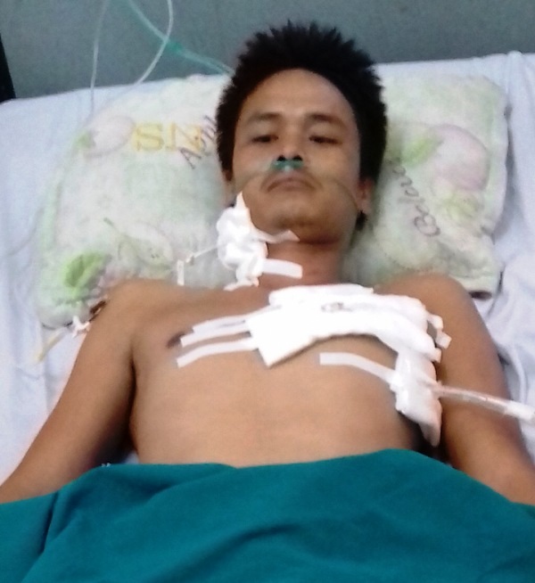 Cứu sống bệnh nhân bị tuốc nơ vít đâm thủng tim - 1 Sau khi phẫu thuật, bệnh nhân Vũ Văn V. đã tỉnh lại và đang hồi phục sức khỏe