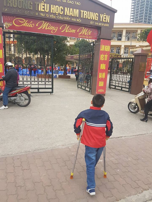 Không khởi tố vụ học sinh bị đâm gãy chân trong trường Nam Trung Yên - 2 Cháu Kiên phải nghỉ học 2 tháng để điều trị vết thương.