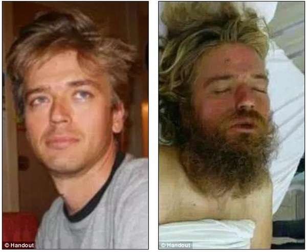 Người đàn ông đi lạc hơn 10.000km sau 5 năm bị "mất tích" - 2 Anton cách đây 5 năm (trái) và khi được tìm thấy (phải)