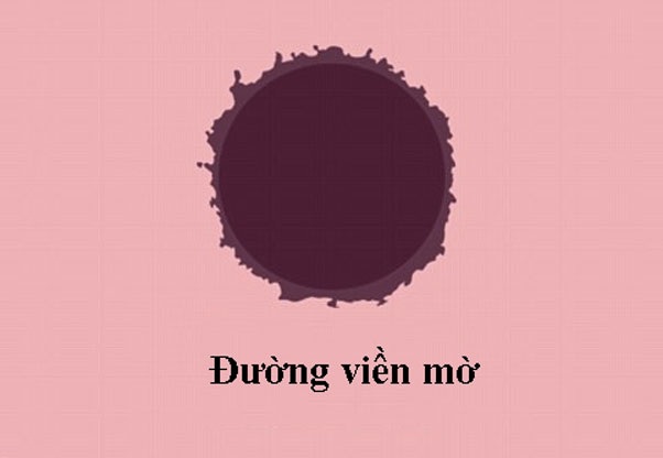 Video: 5 dấu hiệu ung thư của nốt ruồi - 2 Video: 5 dấu hiệu ung thư của nốt ruồi - 2