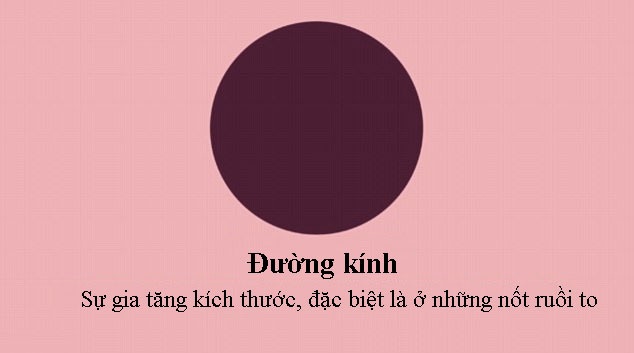 Video: 5 dấu hiệu ung thư của nốt ruồi - 4 Video: 5 dấu hiệu ung thư của nốt ruồi - 4