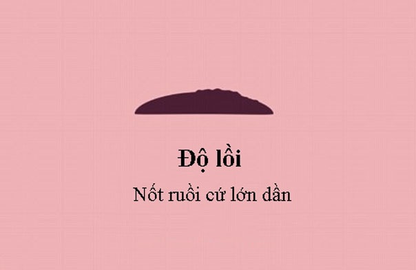 Video: 5 dấu hiệu ung thư của nốt ruồi - 5 Video: 5 dấu hiệu ung thư của nốt ruồi - 5